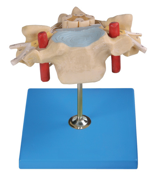 Cervicale Vertrebra met model van de ruggemerg het Menselijke Anatomie toont ruggegraatsslagader, ader, zenuw