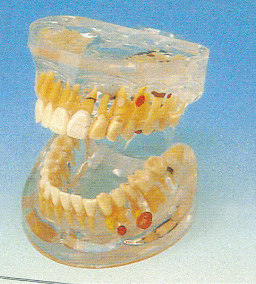 Het volwassen Transparante Tandmodel van Pathologie Menselijke Tanden voor Universiteiten Opleiding