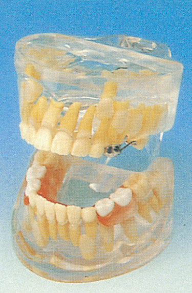 Het tandmodel van de de Melktandenontwikkeling van Scholen Menselijke Tanden Model/Transparante