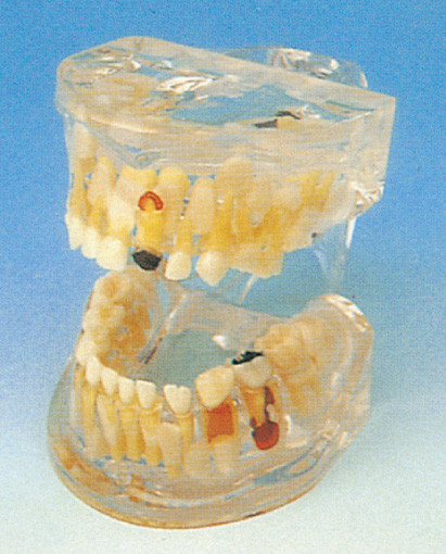 De menselijke Tanden Model/Heldere Pathologie van Melktanden modelleert voor Tandscholen Opleiding