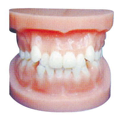 Tandimplant modellen/Orthodontisch Model voor Anatomische Opleiding