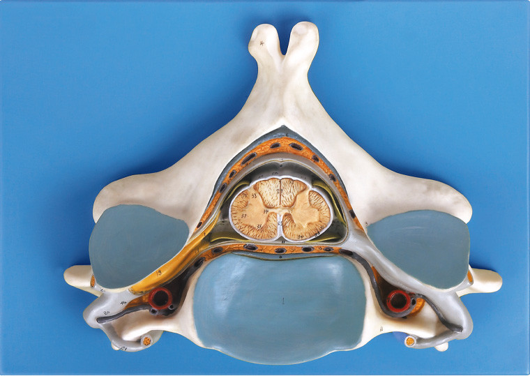 Vijfde cervicale Vertrebra met Ruggemerg en model van het zenuw het anatomische menselijke skelet