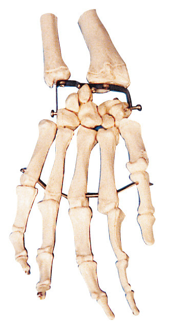 De Anatomie van het palmbeen Menselijk model opleidingsmodel voor medische school