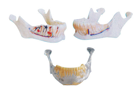 De tandartstanden modelleren Mandibular Model met Zenuwen, Slagaders en Aders