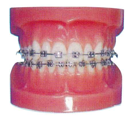Orthodontisch Menselijk Tandenmodel voor de Ziekenhuizen en Tand het Ziekenhuis Opleiding