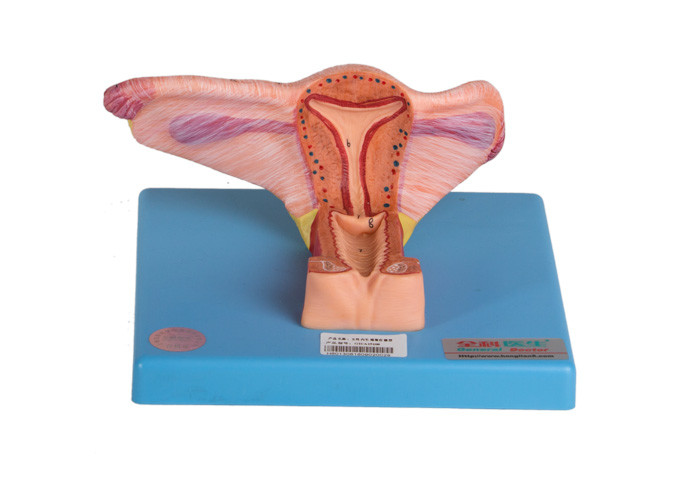 Vrouwelijk Binnen Genitaal Orgaan Modelshows coronal section van Eierstok en Ureter